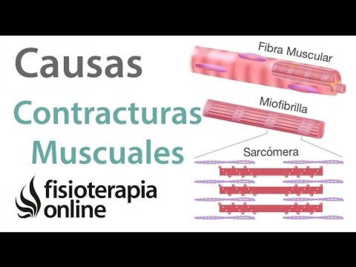 causas de la hipertonia muscular